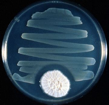 Full Spectrum Biology: Penicillin and the Importance of Medicines From ...