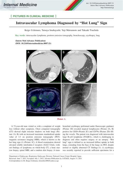 Pdf Intravascular Lymphoma Diagnosed By Hot Lung Sign