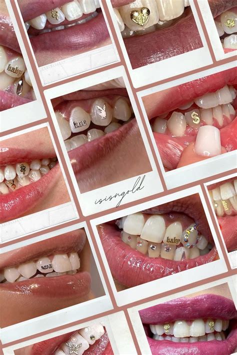 Bijoux Dentaires Ideas Cristales Dental