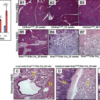 Expression Pattern Of Muc Ac During The Progression Of Pancreatic