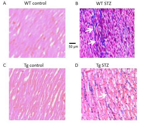 Figure S Gtp Cyclohydrolase Gch Overexpression Decreases