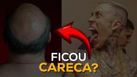 Mc Daniel Ficou Careca Youtube