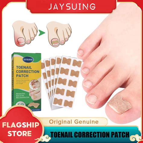 Jaysuing Nail Correction Stickers Ingrown Toenail Corrector Patches