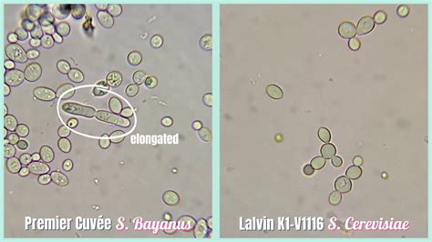 Bacterial Cells Under A Microscope