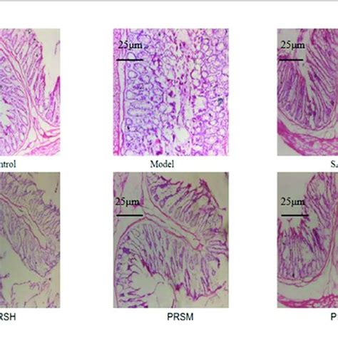 Histopathological Changes Were Improved By Prs Saponins The Colons