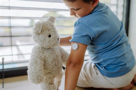 Stockfoto Med Beskrivningen Diabetic Boy With A Continuous Glucose