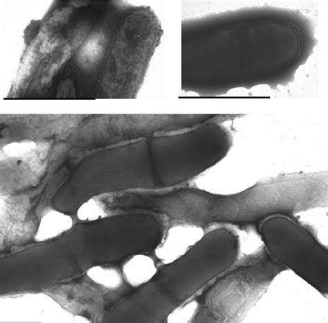 Negatively Stained Tem Micrographs Of Fuso Fusobacterium Sp Top