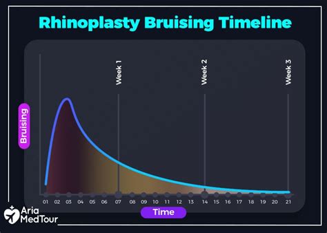 Everything You Need To Know About Bruising After Rhinoplasty