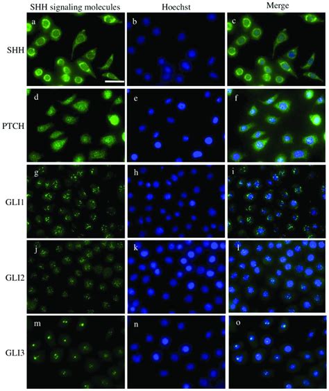 Immunocytochemical Staining Of SHH PTCH GLI1 GLI2 And GLI3 In AM 1