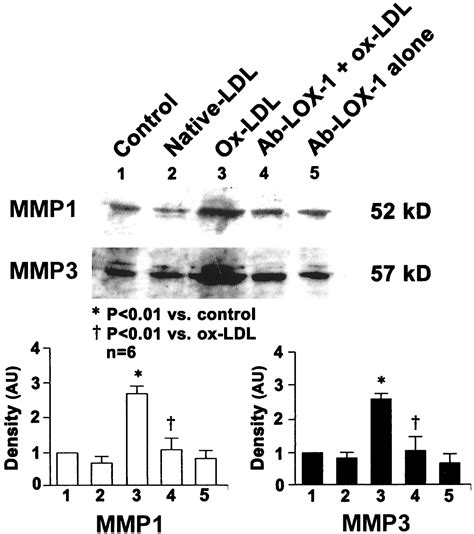 Lox 1 Mediates Oxidized Low Density Lipoprotein Induced Expression Of