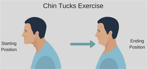 McKenzie Chin Tuck Exercise: How To Do It (Video), Before & After, Side ...