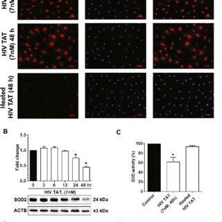 HIV TAT Mediated Increased Mitochondrial ROS And Decreased Expression