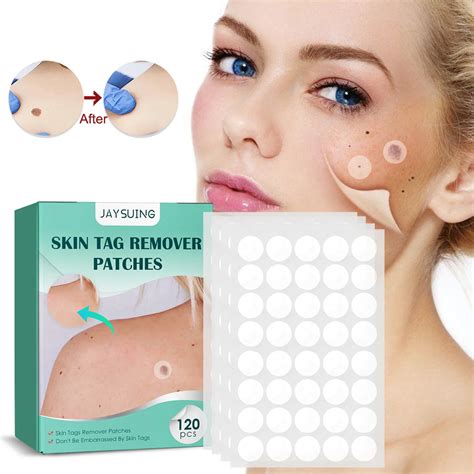 120 P S Caixa Verrugas Removedor Patch Skin Tag Tratamento Creme