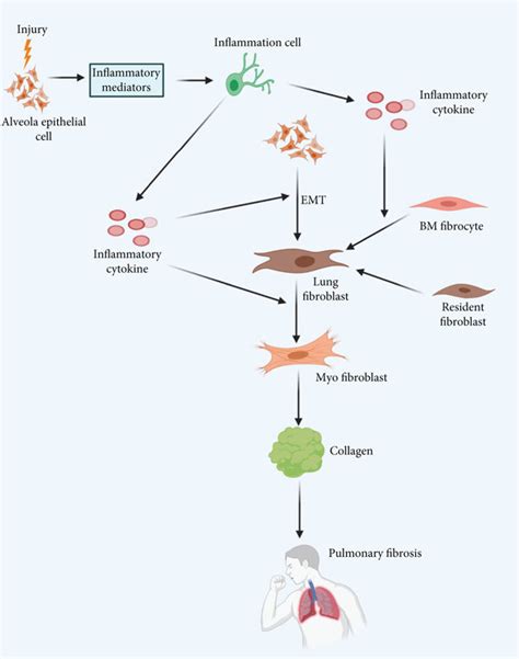 Pathogenesis Of Idiopathic Pulmonary Fibrosis