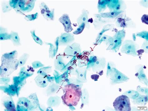 Pathology Outlines Cytology Nonneoplastic