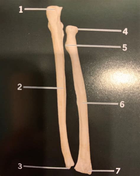 Right Radius And Ulna Posterior View Diagram Quizlet