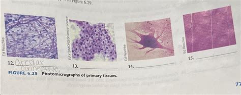 Solved Aredarfigure Photomicrographs Of Primary Chegg