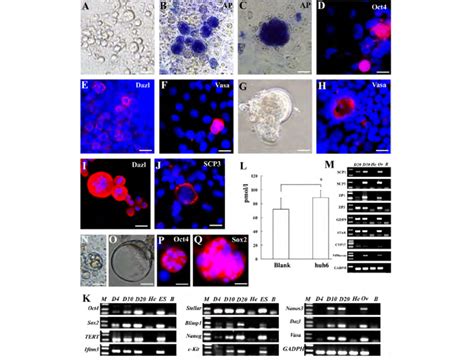 Characteristics of germ cell-like cells. (A) Small round cells appeared ...