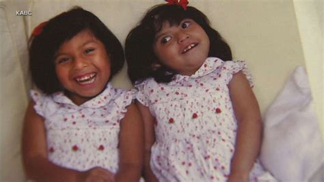 Formerly Conjoined Twins Celebrate 21st Birthday And 20th Anniversary Of Separation Abc News