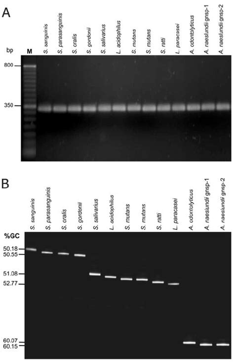 Pcr Dgge Analysis Of 16s Rdna Gene Fragments Of Atcc Type Strains A Download Scientific