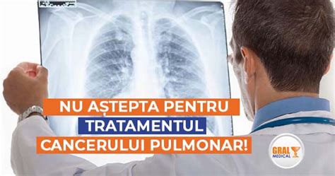 Nu Astepta Pentru Tratamentul Cancerului Pulmonar Orice Zi Face Diferenta