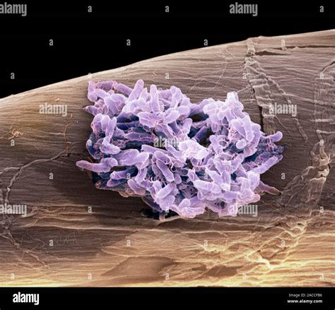 La Bacteria Salmonella Typhimurium Color Micrograf A An Lisis De