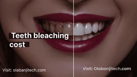 How Much Does Professional Teeth Bleaching Cost