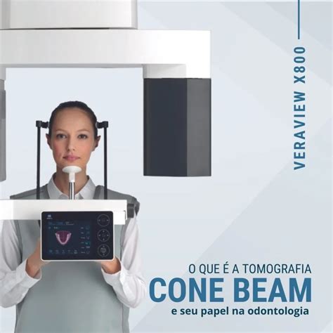 O QUE É A TOMOGRAFIA CONE BEAM E SEU PAPEL NA ODONTOLOGIA Studio RX