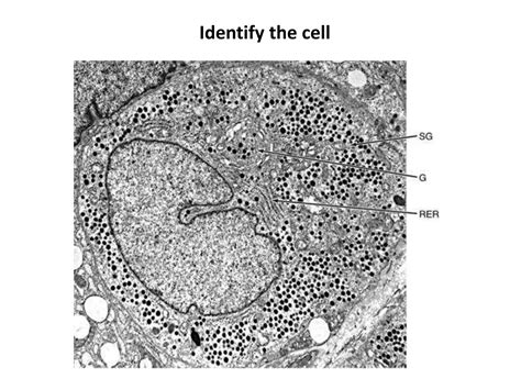Histology Of Thyroid Follicle Ppt