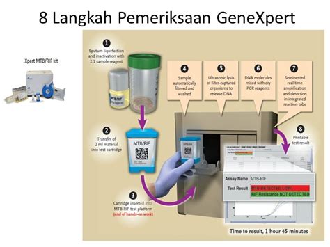 Pemeriksaan Tes Cepat Molekuler Laboratorium Tb Ppt Download