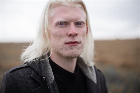 Portrait of a Young, Beautiful Albino Man with Blue Eyes. Stock Photo ...