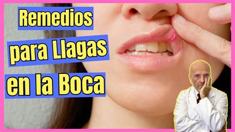 REMEDIOS CASEROS PARA LLAGAS EN LA BOCA Y LENGUA COMO CURAR UNA