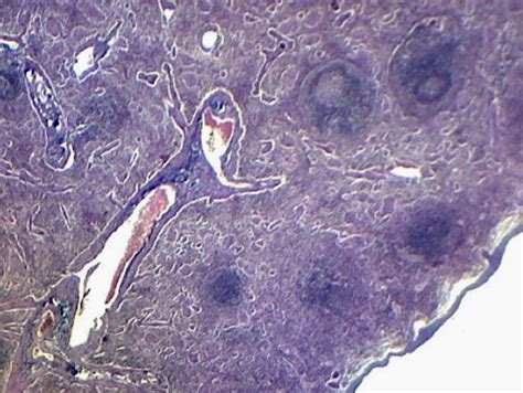 Spleen Micrograph Diagram Quizlet