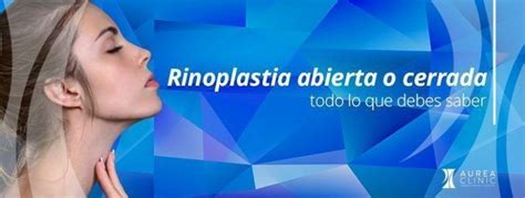 Rinoplastia Abierta O Cerrada ¿qué Técnica De Abordaje Es Mejor