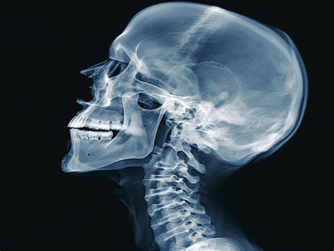 Premium Photo Human Skull Xray Image