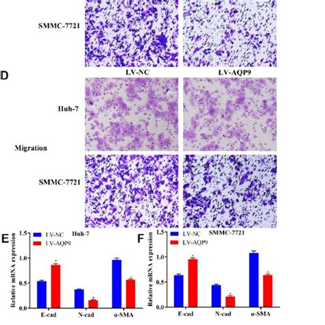 Overexpressed Aqp Inhibited Invasion Migration And Emt In Hcc Cells