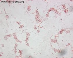 Salmonella Enterica Gram Stain