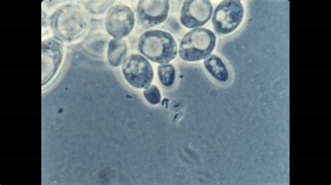 Yeast Cells Budding