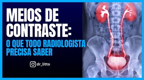 Meios De Contraste O Que Todo Radiologista Precisa Saber Youtube