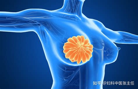 女金中医张主任：乳腺结节患者可以吃阿胶吗？ 知乎