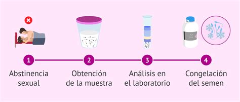 Seminograma Para Los Donantes De Esperma