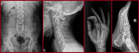 General X Ray Brighton Radiology