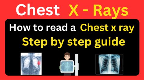 How To Read A Chest X Ray Step By Step Guide Physio Talk Official