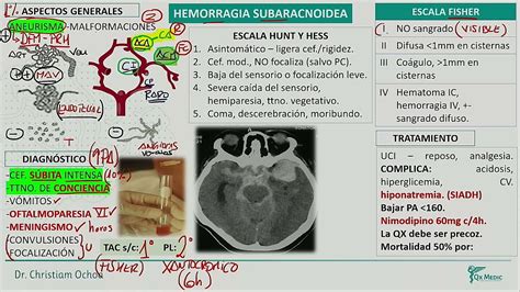 Neurología Hemorragia subaracnoidea YouTube