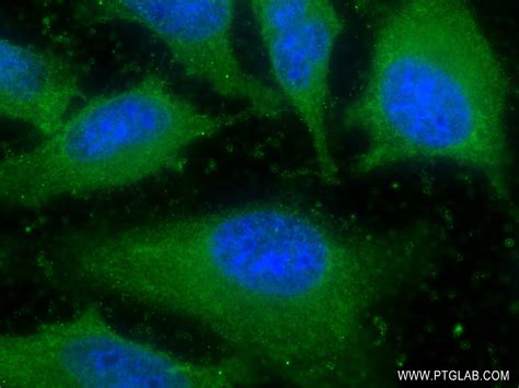 Timp Antibody Rr Proteintech