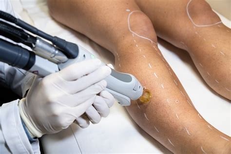 Epilation Laser Des Jambes Strasbourg Dermo Laser Strasbourg