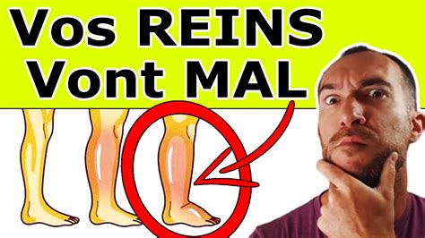 Reins Malades 9 SymptÔmes Qui Doivent Vous Alerter Maladies Rénales