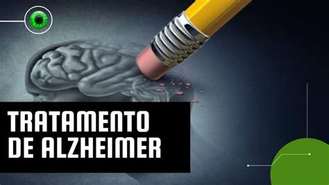 Alzheimer Novo Medicamento Mostra Potencial Para Retardar Perda