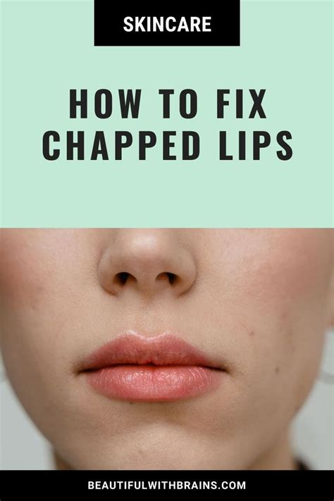 Chapped Lips Ways To Heal Them Quickly Beautiful With Brains