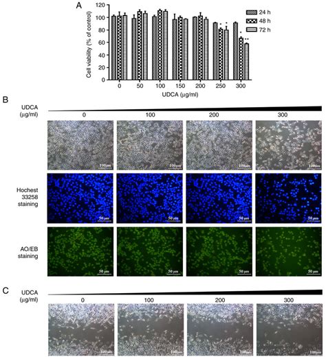 Udca Inhibited Cell Proliferation Motility Ability And Induced Download Scientific Diagram